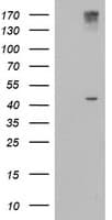 AGPAT5 Antibody (clone OTI5F4)