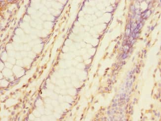 Polyclonal Rabbit anti-Human TNFAIP8 / SCC-S2 Antibody (IHC, WB)
