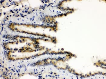 Polyclonal Rabbit anti-Human XBP1 Antibody (aa55-89, IHC, WB)