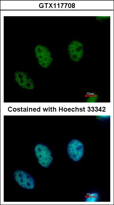 CDYL Antibody
