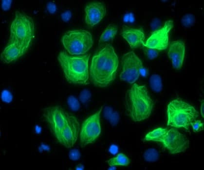 Monoclonal Mouse MYC / c-Myc Antibody (aa408-432, IF, WB)
