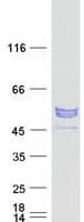 Human KATNAL2 Protein (Recombinant Myc-DDK (Flag))