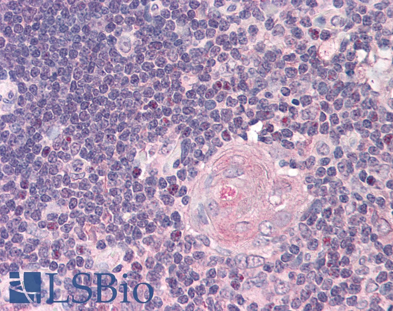 IHC-plus™ NFKB2 Antibody