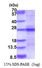Mouse IL6 / Interleukin 6 Protein (Recombinant His)