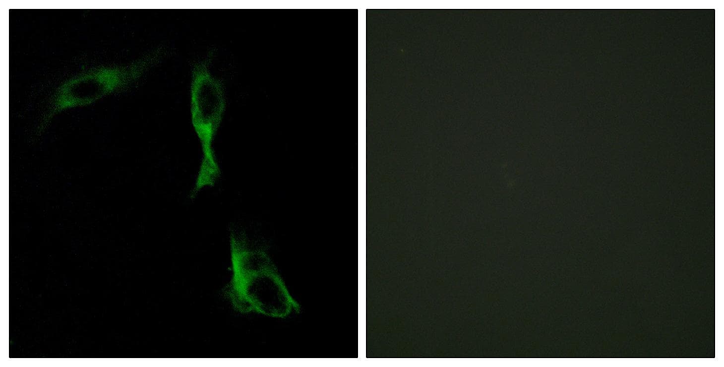 ADRA1D / Adrenoceptor alpha 1D Antibody
