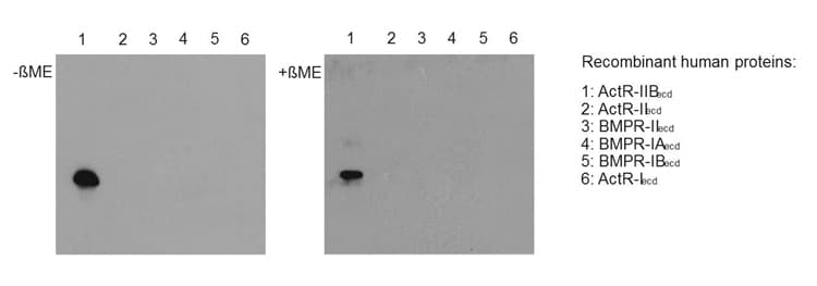 Polyclonal Rabbit anti-Mouse ACTRIIB / ACVR2B Antibody (Extracellular Domain, WB)