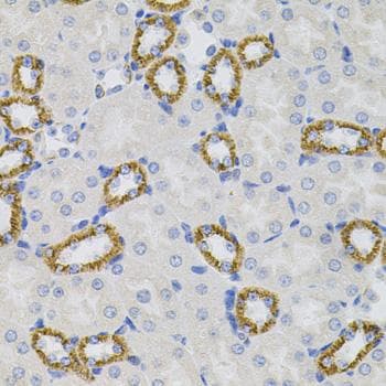 OPRS1 / SIGMAR1 Antibody