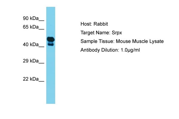 SRPX Antibody (aa206-255)