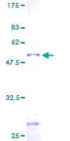 Human ZNF22 Protein (Recombinant GST)