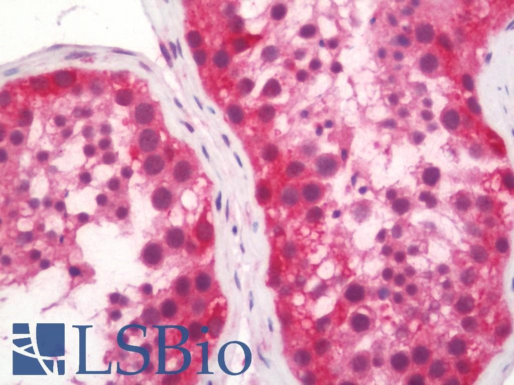 IHC-plus™ PKM / Pyruvate Kinase, Muscle Antibody (aa383-417)