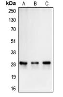 Polyclonal Rabbit anti-Human CA2 / Carbonic Anhydrase II Antibody (C-Terminus, IHC, WB)