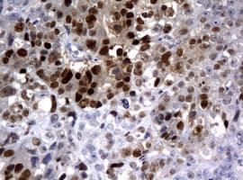 PCNA Antibody (clone OTI6B6)