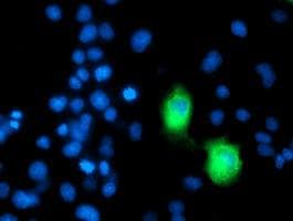 ERBB2 / HER2 Antibody (aa676-1255, clone OTI9G2, Carrier-free)