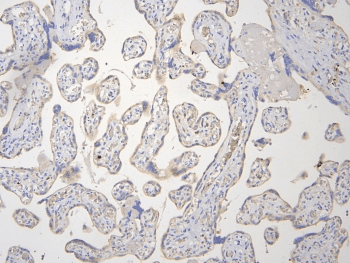 BMAL2 / ARNTL2 Antibody