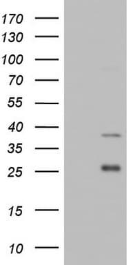 Monoclonal Mouse anti-Human IRAK2 / IRAK-2 Antibody (clone OTI1B4, aa362-625, WB)