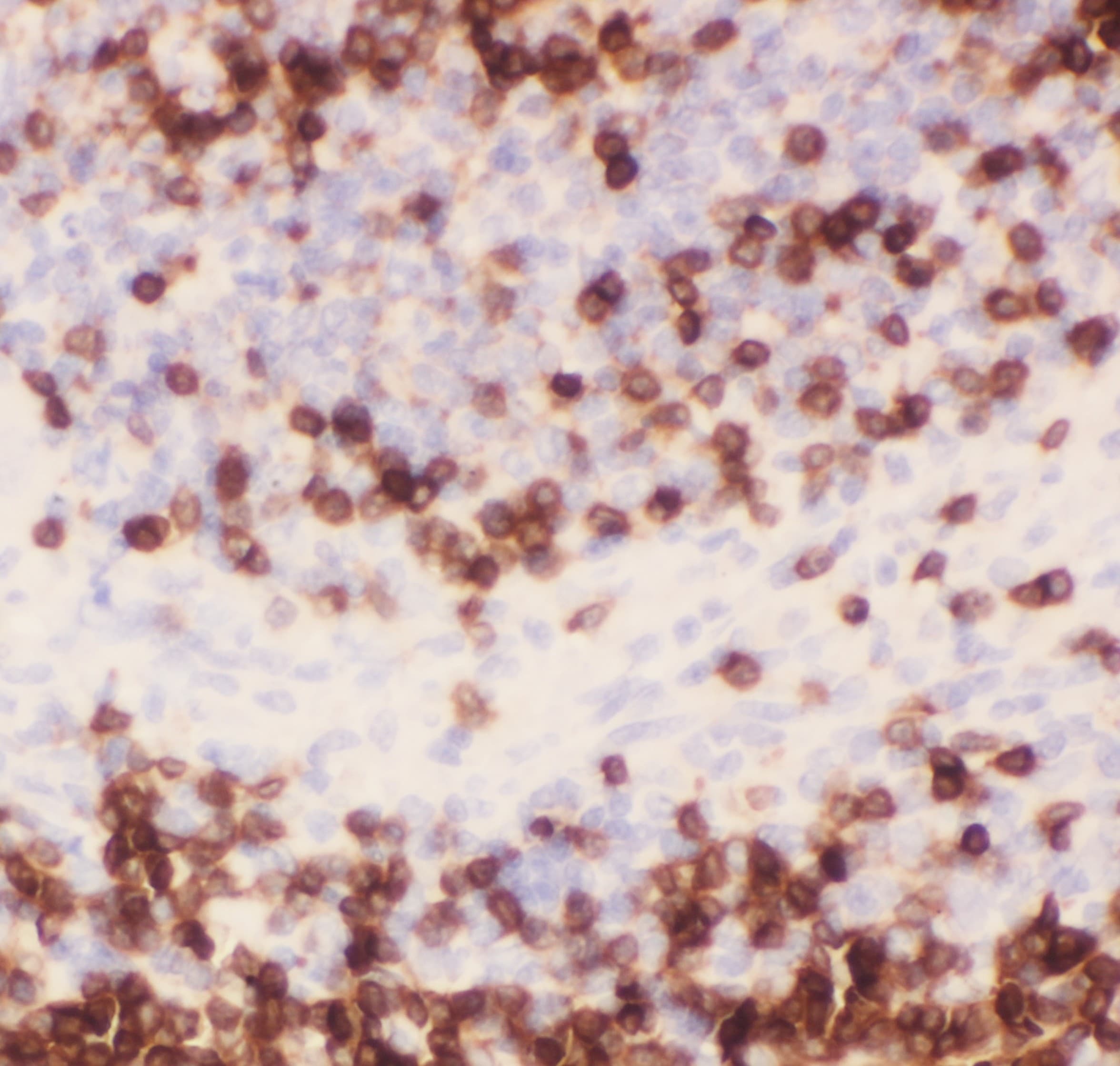 CD3E Antibody (aa23-207)