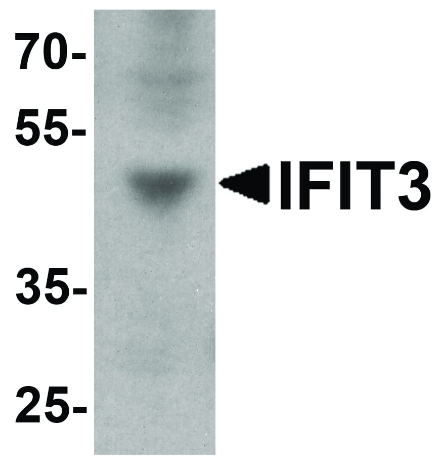Polyclonal Rabbit anti-Human IFIT3 Antibody (IHC, WB)