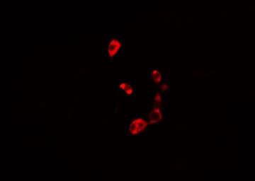 Polyclonal Rabbit anti-Human AKR1B1 / Aldose Reductase Antibody (IF, WB)