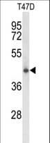 Polyclonal Rabbit anti-Human CLN5 Antibody (aa41-69, WB)