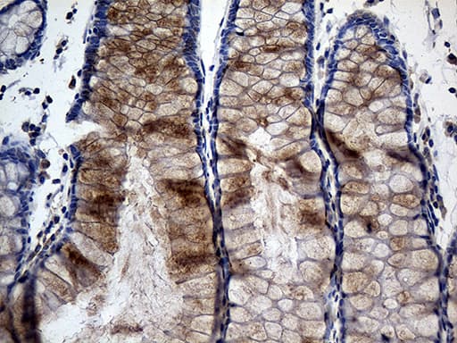 TANK Antibody (clone OTI1G2)