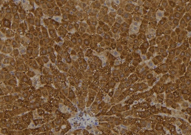 ARL11 Antibody