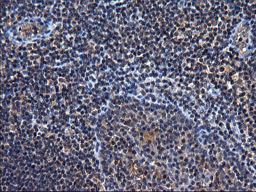 TXNDC5 / ERP46 Antibody (clone OTI2E6)