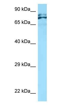 Polyclonal Rabbit anti-Human C1orf38 Antibody (aa325-374, WB)