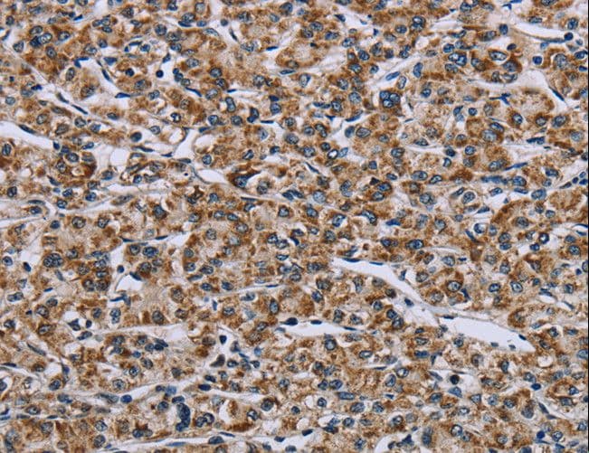 GTPBP10 Antibody
