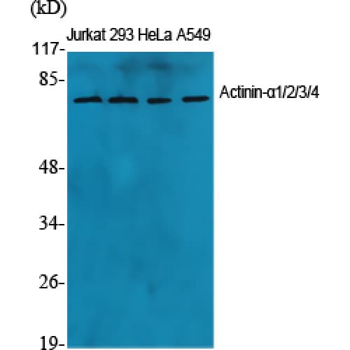 ACTN1 Antibody (40-120 aa, N-terminal)
