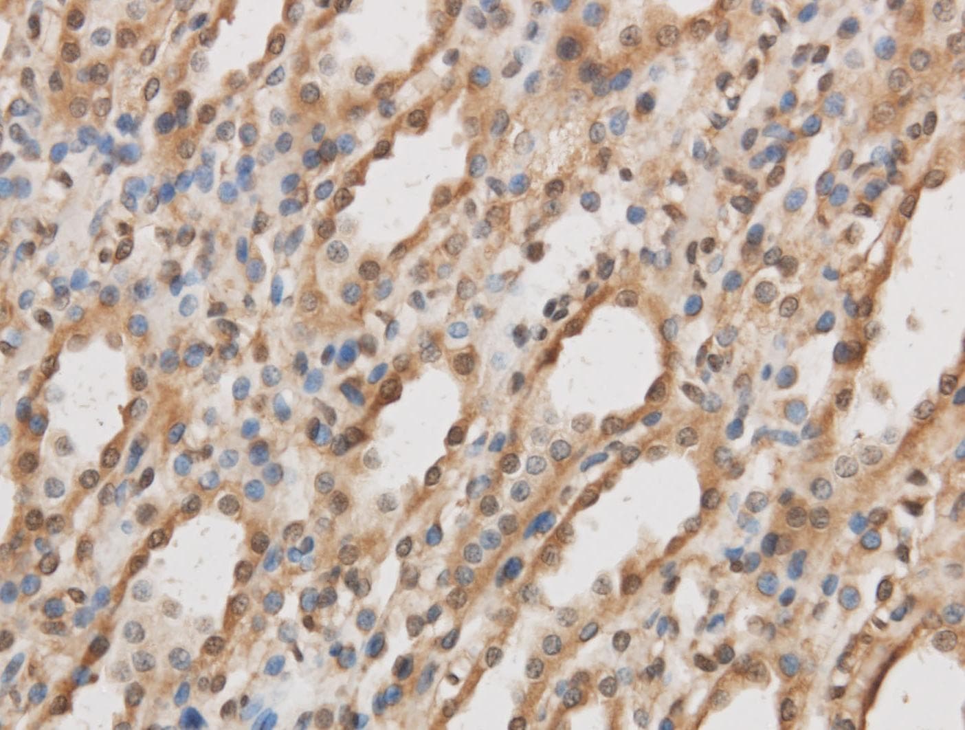 IL10RB Antibody