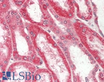 IHC-plus™ SLC7A2 Antibody (aa608-658)