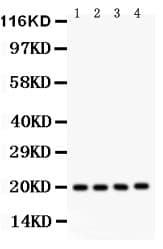 PARK7 / DJ-1 Antibody (aa2-189)