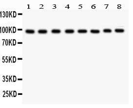 CD71 / Transferrin Receptor Antibody (aa1-198)