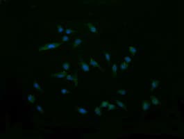 CTAG1B / NY-ESO-1 Antibody (clone OTI9E7)