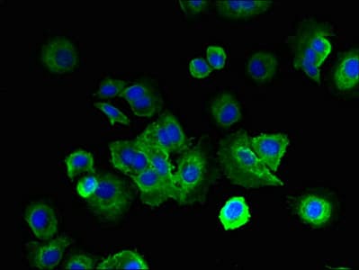 Polyclonal Rabbit anti-Human LRRC4C Antibody (IHC)