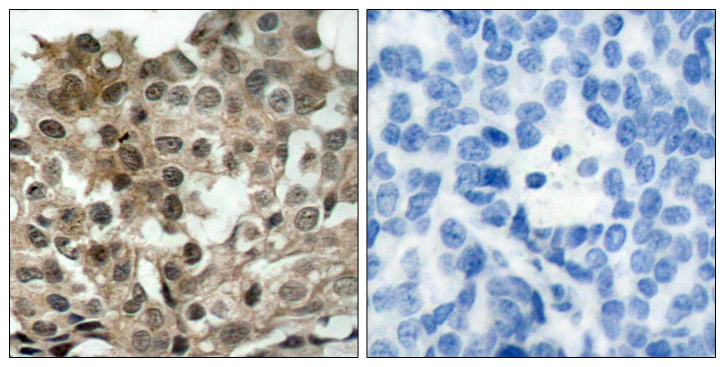 FOXO3 / FOXO3A Antibody (p253)
