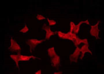 Olfactory Receptor, Family 5, Subfamily BA, Member 1 Pseudogene (OR5BA1P) Antibody