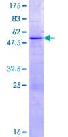 Human KLK11 / Kallikrein 11 Protein (Recombinant GST)
