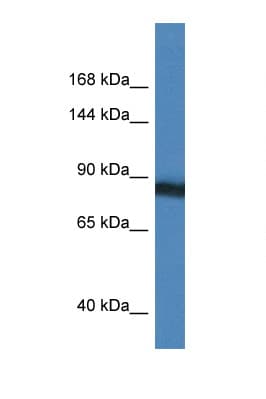 Polyclonal Rabbit anti-Human SEMA4D / Semaphorin 4D / CD100 Antibody (aa90-139, WB)
