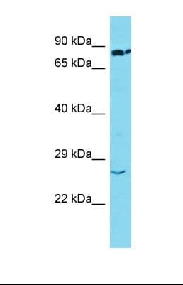 SSX2 Antibody (aa100-148)