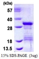 Human VTI1B Protein (Recombinant His)