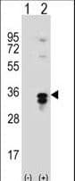 PPT1 / CLN1 Antibody (aa269-300)