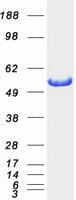 Human ALDH7A1 Protein (Recombinant Myc-DDK (Flag))