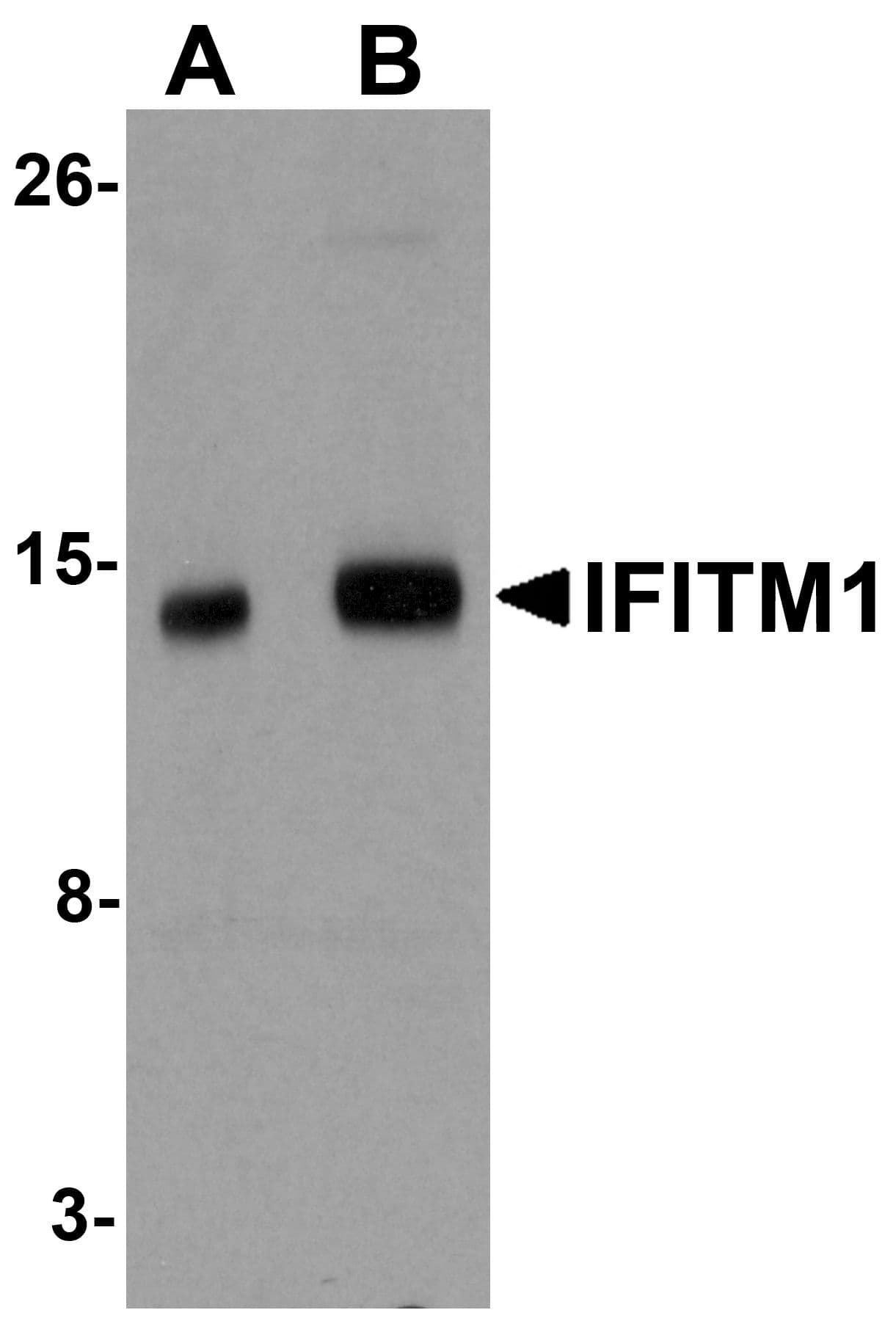 IHC-plus™ Polyclonal Rabbit anti-Human CD225 / IFITM1 Antibody (IHC, IF, WB)