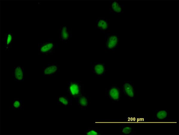 IHC-plus™ HDAC1 Antibody (clone 1D6)