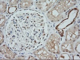 MAP2K1 / MKK1 / MEK1 Antibody (clone OTI2B7)
