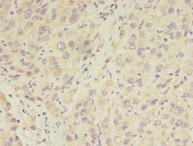 RPGR Antibody