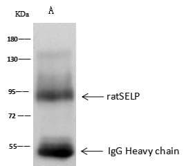 SELP / P-Selectin / CD62P Antibody (Preservative Free)