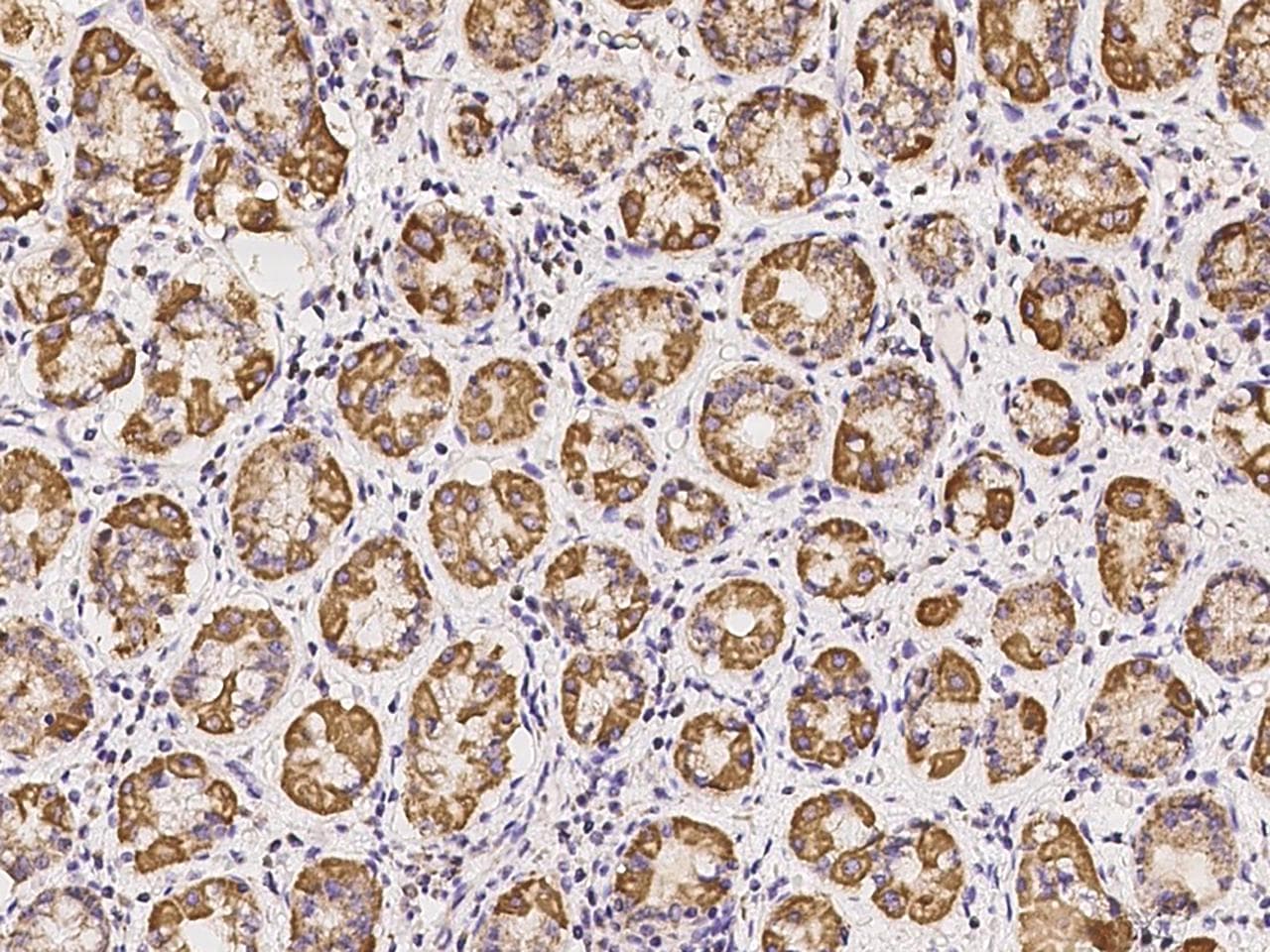 SUCLG1 / GALPHA Antibody