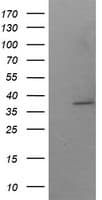 IHC-plus™ SAE1 Antibody (clone 1G8)